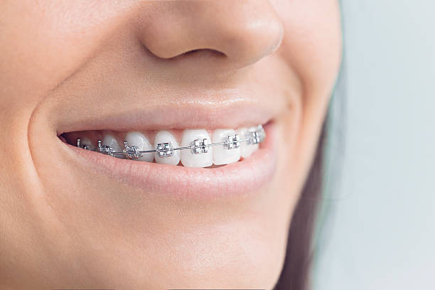 Best Dental Fillings (Composite and Amalgam)  in Harvard, NE